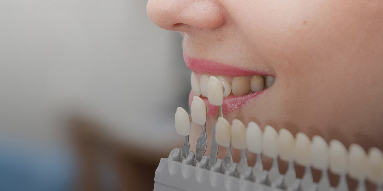 In Clearwater Are Holistic Dentist Explains What You Need to Know About Comprehensive and Holistic Teeth Cleaning. 