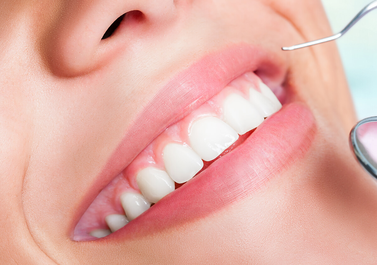Holistic Dental Benefits in Clearwater FL Area 