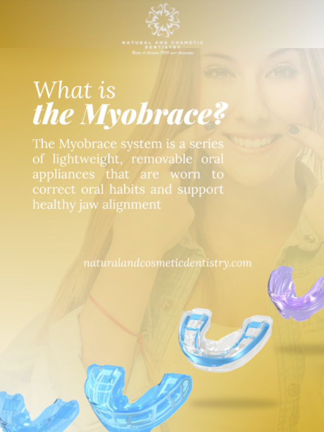 What is Myobrace?