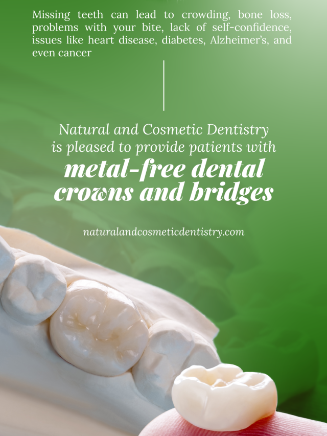 Metal-Free Dental Crowns and Bridges